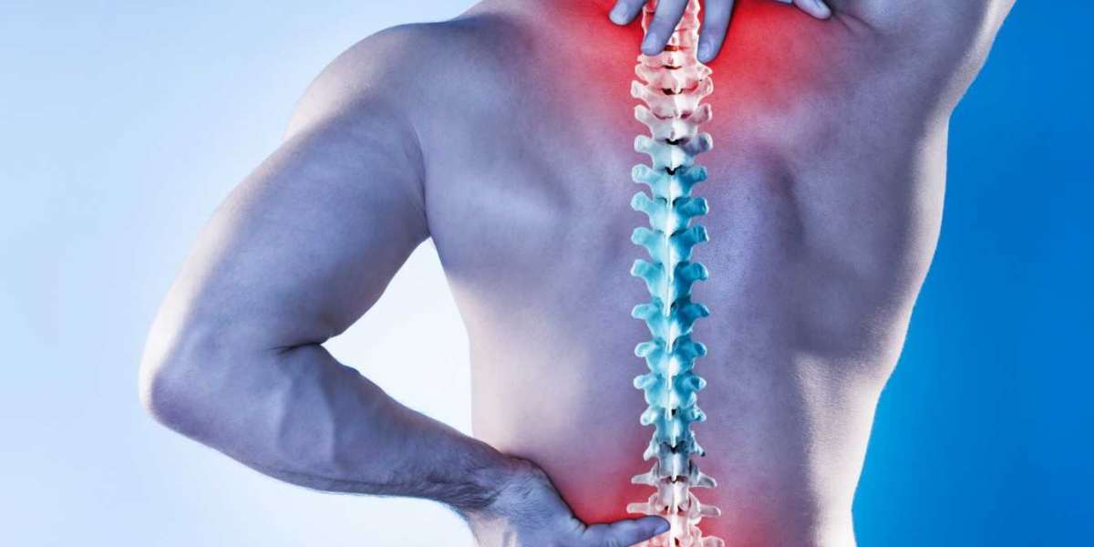 Severe Back Pain Management Techniques