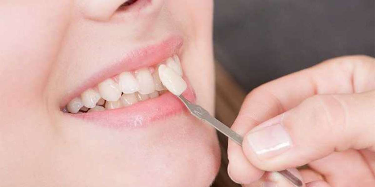 5 Common Smile Problems Solved by Dentists in Toronto