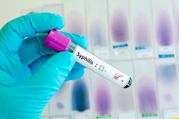 Can You Really Treat Syphilis at Home? Exploring the Dangers of DIY Solutions | by Good Professional Doctor | May, 2024 | Medium